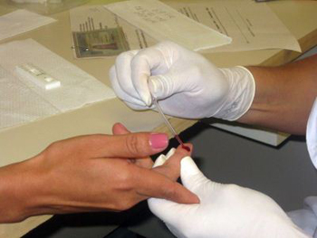Hoje, o teste para se detectar a Aids pode ser  feito de forma simples, com gotas de sangue (Mara Puljiz/C.B/DA Press)