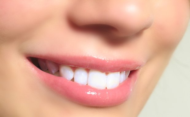A partir de agora, a divulgação e a venda de clareadores de dente fica muito mais restrita (Pixabay)