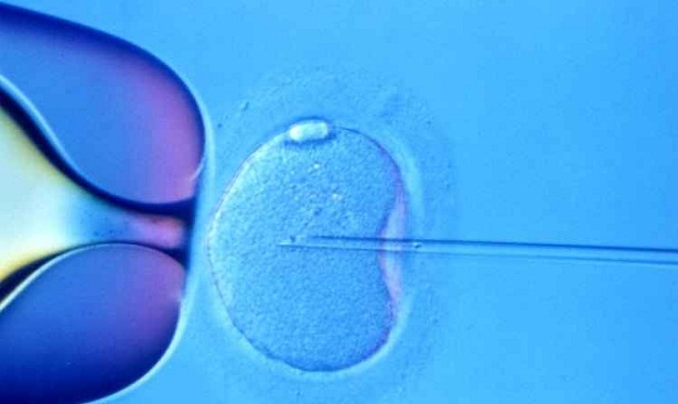 Apesar da resoluo do CFM liberar fertilizao in vitro para mulheres a partir de 50 anos, mdico recomenda cautela, devido aos riscos da gravidez nessa idade (Myhealthblogs.com/Reproduo)