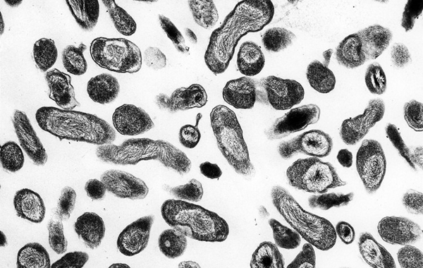 A bactéria Coxiella burnetii, causadora da febre Q, é muito resistente e pode ser transmitida aos humanos pelo ar ou pelo contato com secreções de animais domésticos  (Wikimedia/Reprodução)