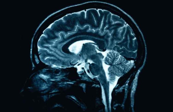 Por meio de um chip ligado diretamente ao crebro de pacientes no ltimo estgio da esclerose lateral amiotrfica, cientistas foram capazes de ler os pensamentos e fazer os doentes se comunicarem (Infokid.org.uk/mri/Reproduo)